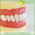 EN-L3 Removable Dental Soft Peridontal Teeth Model for Training
